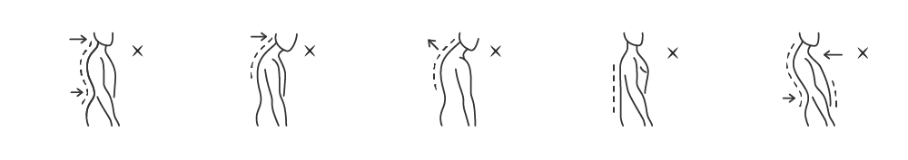 spinal curve issues treatment colliers wood