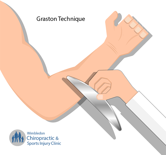 Understanding the Graston Technique