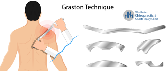 Application in Myofascial Therapy