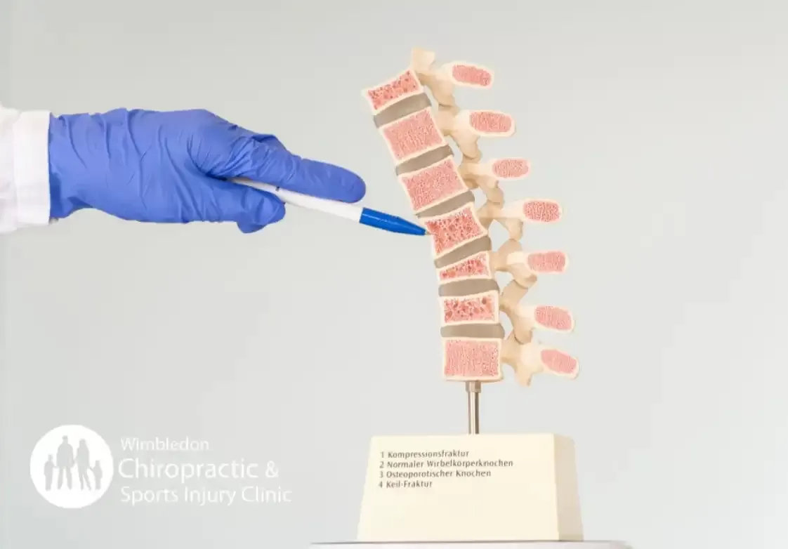 Vertebral Wedging: Radiological Classification