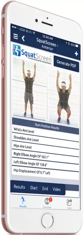 SquatScreen: A Game-Changer in Functional Movement Assessments